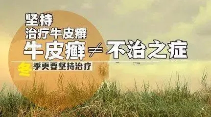 牛皮癣能治好吗